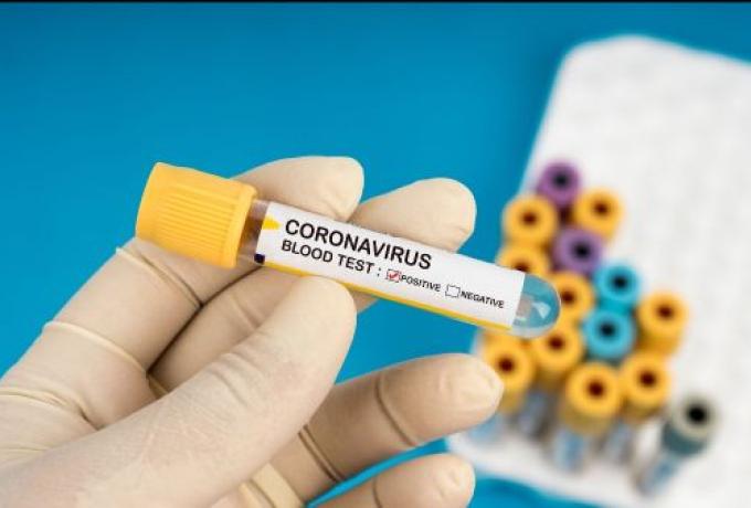 TUC Education produce coronavirus e-learning organising guide