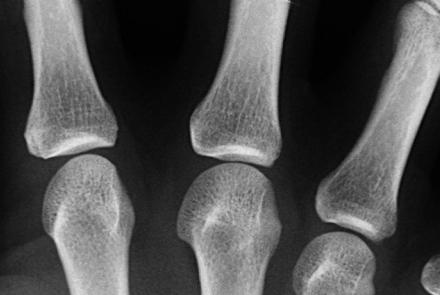 Radiographers
